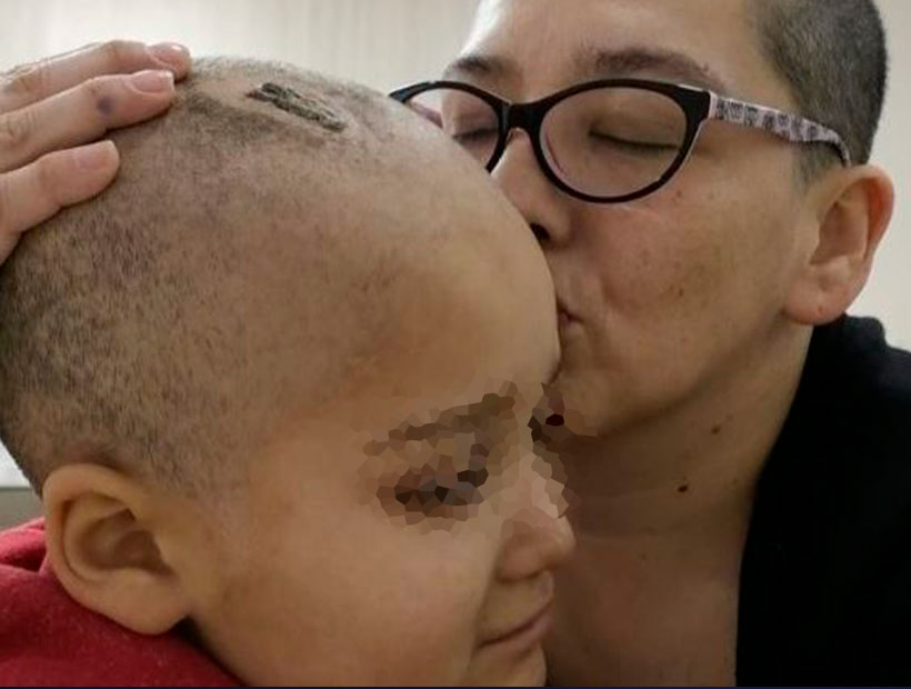Mujer con cáncer lucha por la vida de su hijo con tumor cerebral