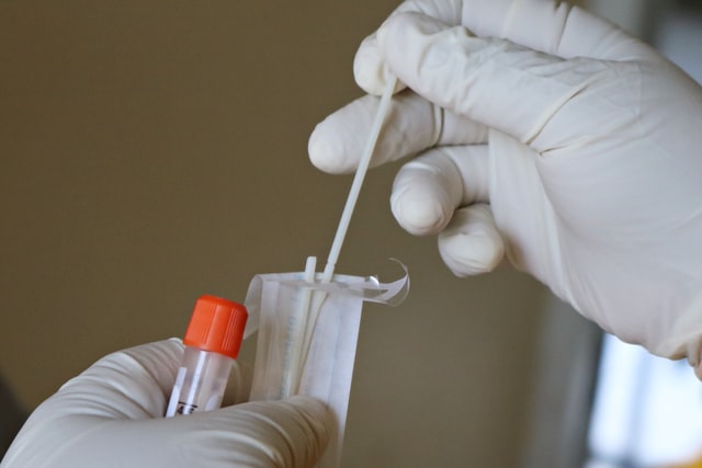 Entérate de los puntos de testeo dispuestos por la Seremi de Salud para mañana en la Región de Valparaíso